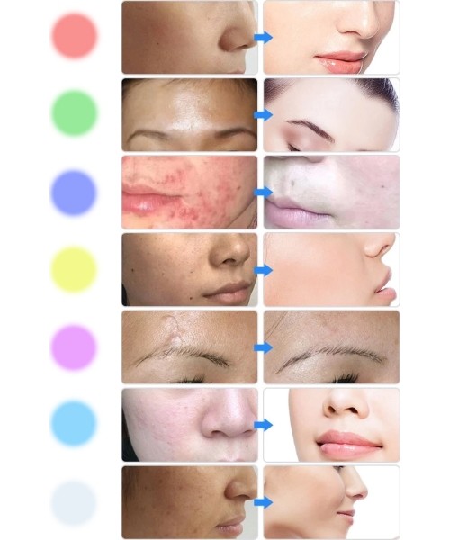 LED Light Therapy Face Mask inSPORTline Esgrima