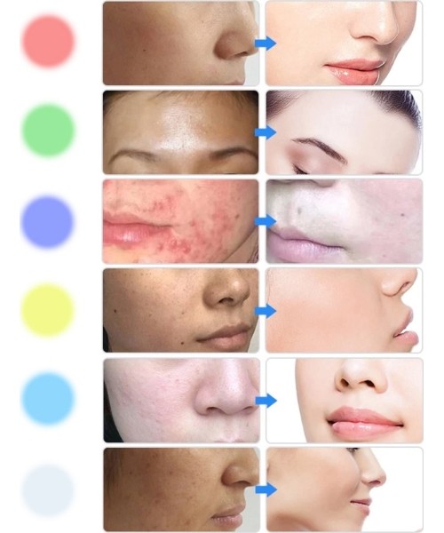 LED Light Therapy Facial Machine inSPORTline Coladome 600